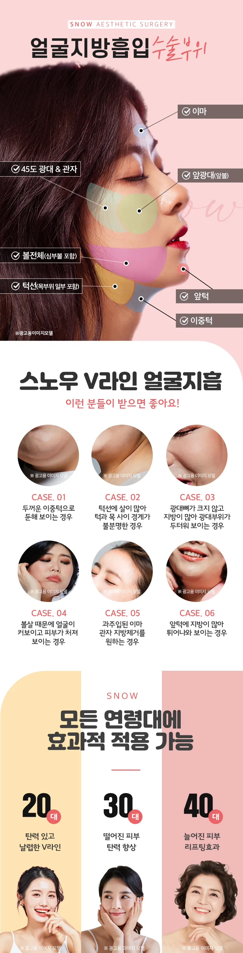 스노우의원 대용량 얼굴지방흡입 이벤트, 시술 상세 이미지