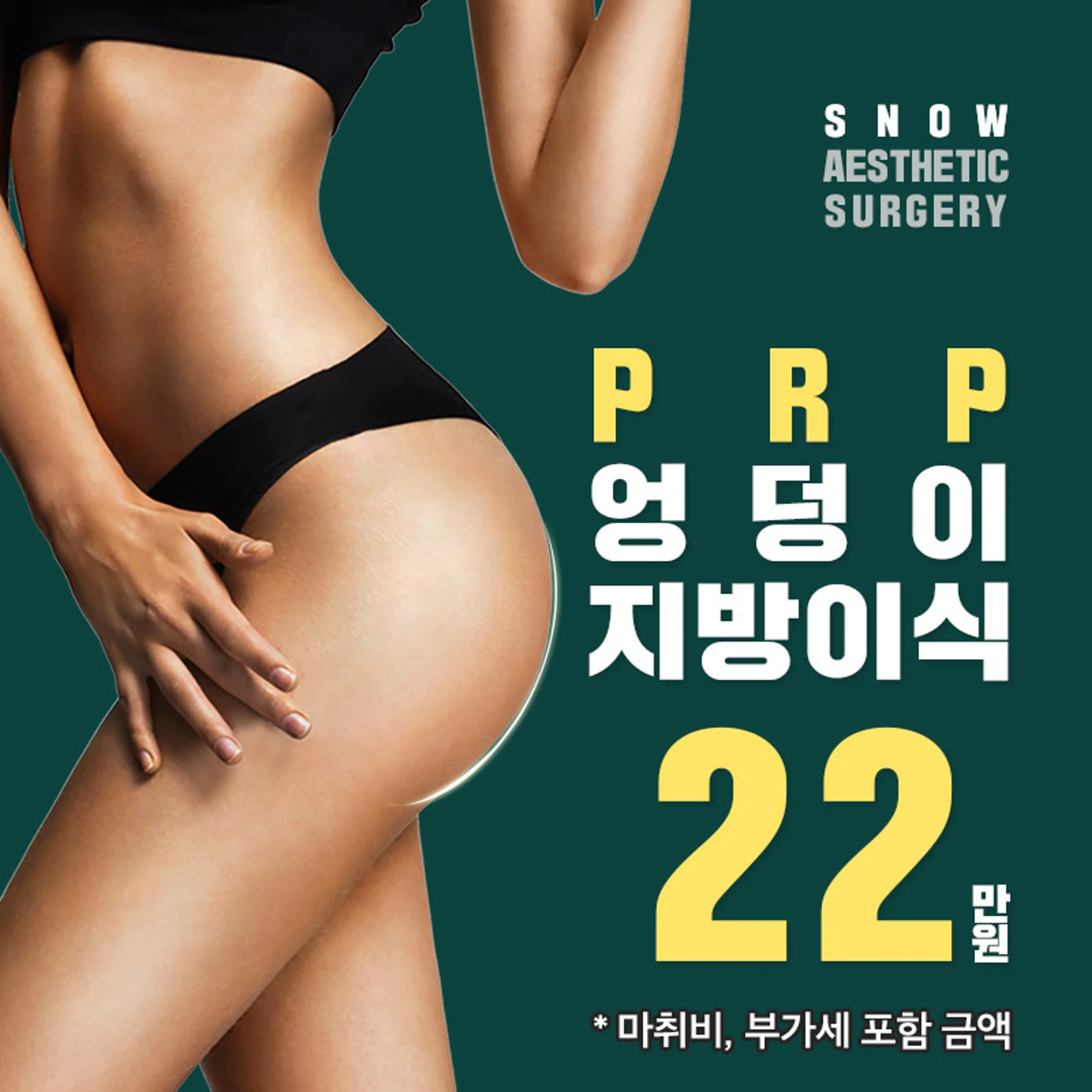 힙업 PRR 엉덩이지방이식