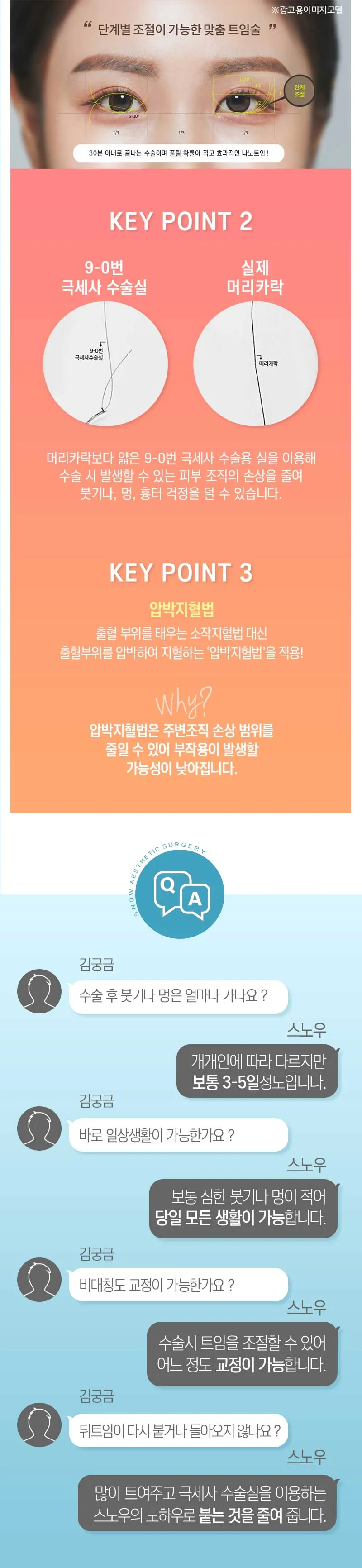 스노우의원 블링블링 나노트임 이벤트, 시술 상세 이미지