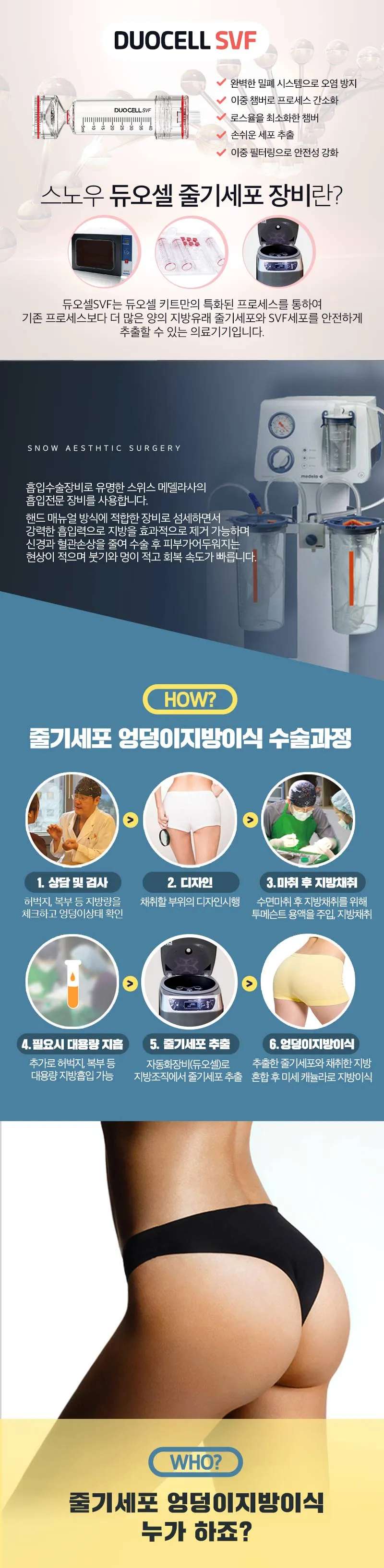 스노우의원 줄기세포 힙업 엉덩이지방이식 이벤트, 시술 상세 이미지