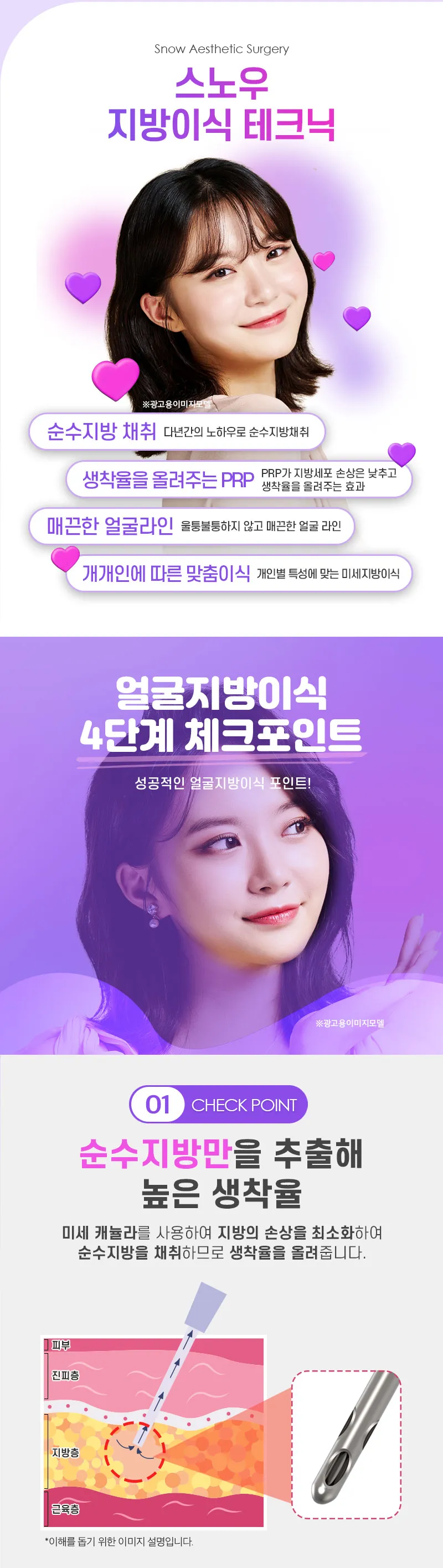 스노우의원 PRP 얼굴지방이식 이벤트, 시술 상세 이미지