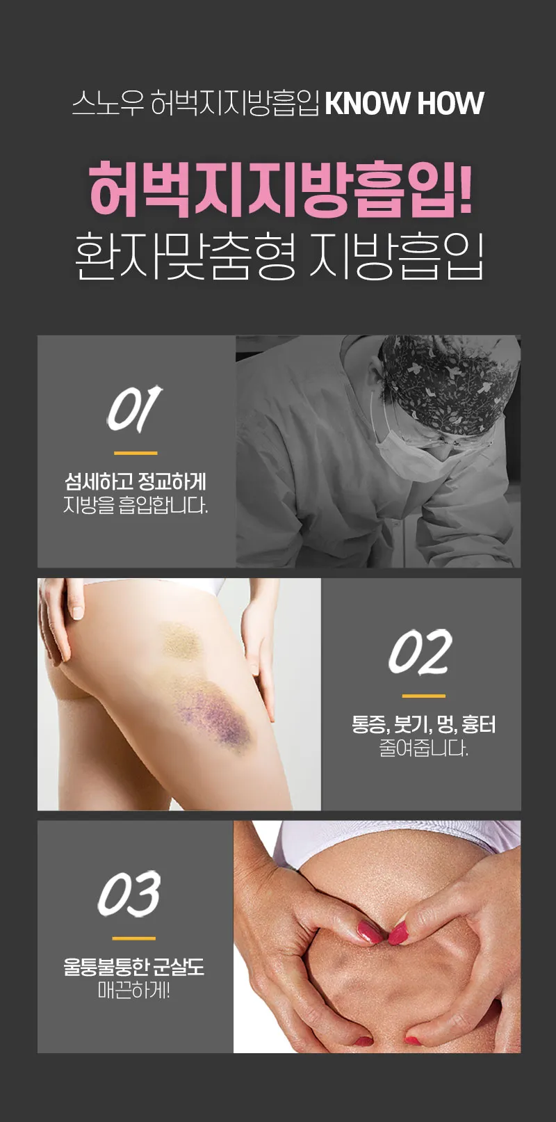 스노우의원 대용량 허벅지 지방흡입 이벤트, 시술 상세 이미지