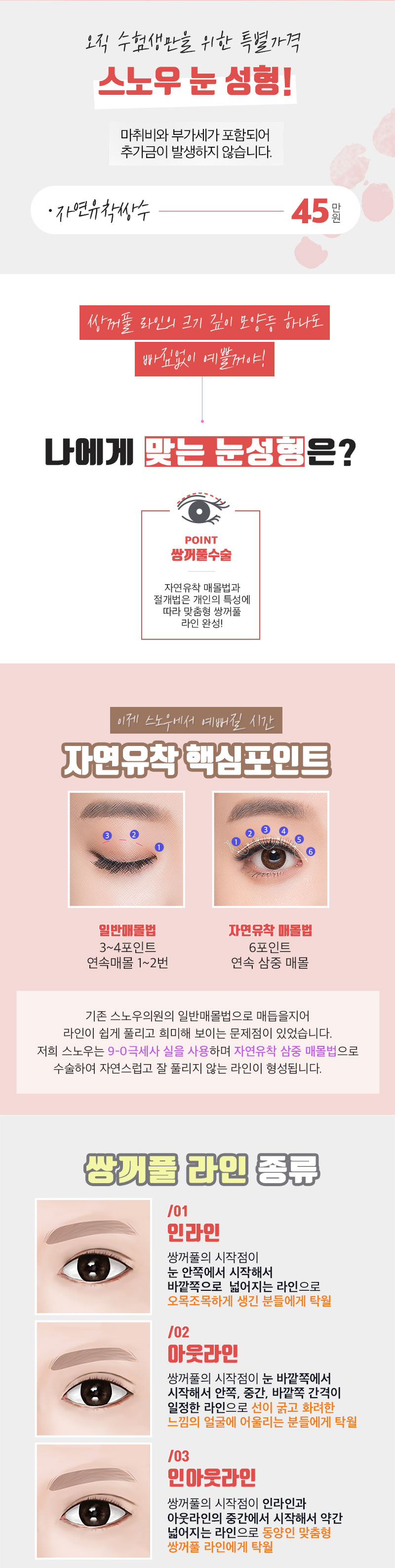 스노우의원 수험생 자연유착쌍수 이벤트 이벤트, 시술 상세 이미지