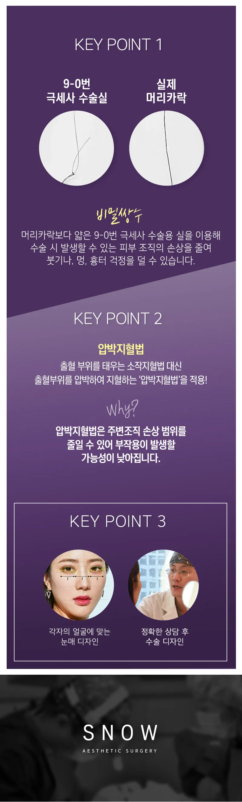 스노우의원 비밀눈성형 절개 눈재수술 이벤트, 시술 상세 이미지