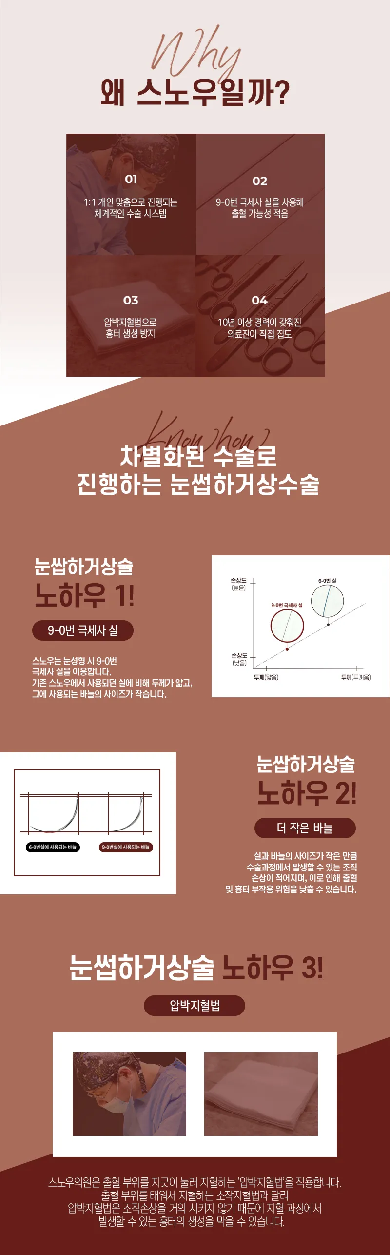 스노우의원 중년눈성형 상안검 눈썹하거상 이벤트, 시술 상세 이미지