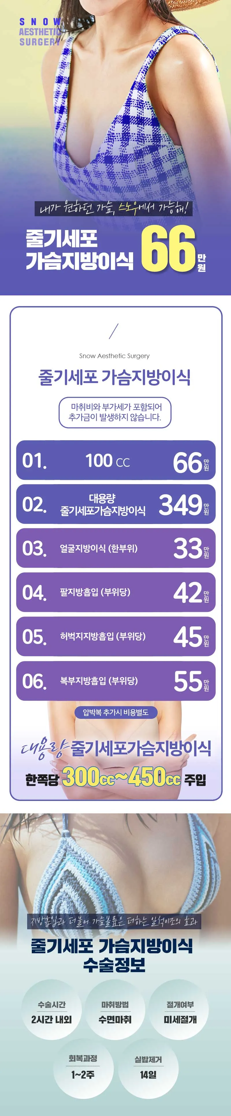 스노우의원 줄기세포 가슴지방이식 이벤트, 시술 상세 이미지