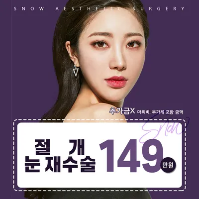 비밀눈성형 절개 눈재수술 이벤트 썸네일 이미지