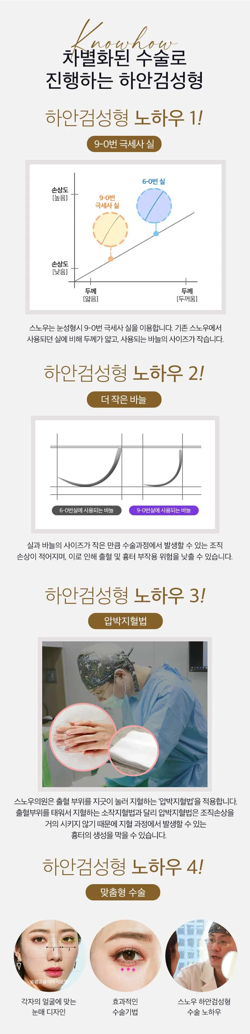 스노우의원 중년 눈성형 하안검 이벤트, 시술 상세 이미지