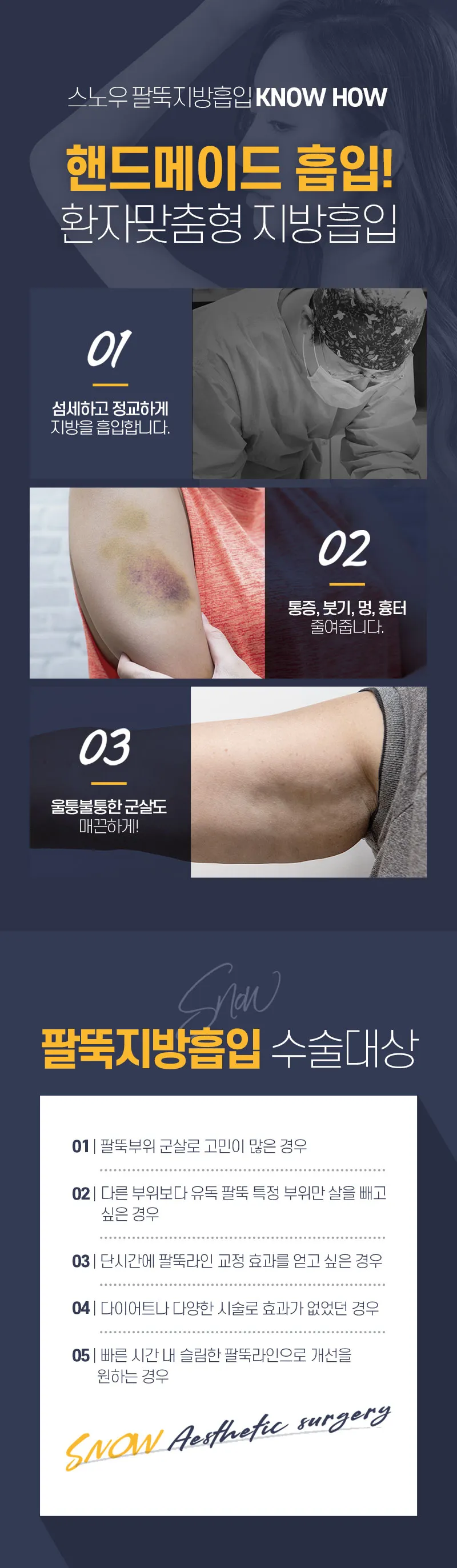스노우의원 대용량 팔 지방흡입 이벤트, 시술 상세 이미지