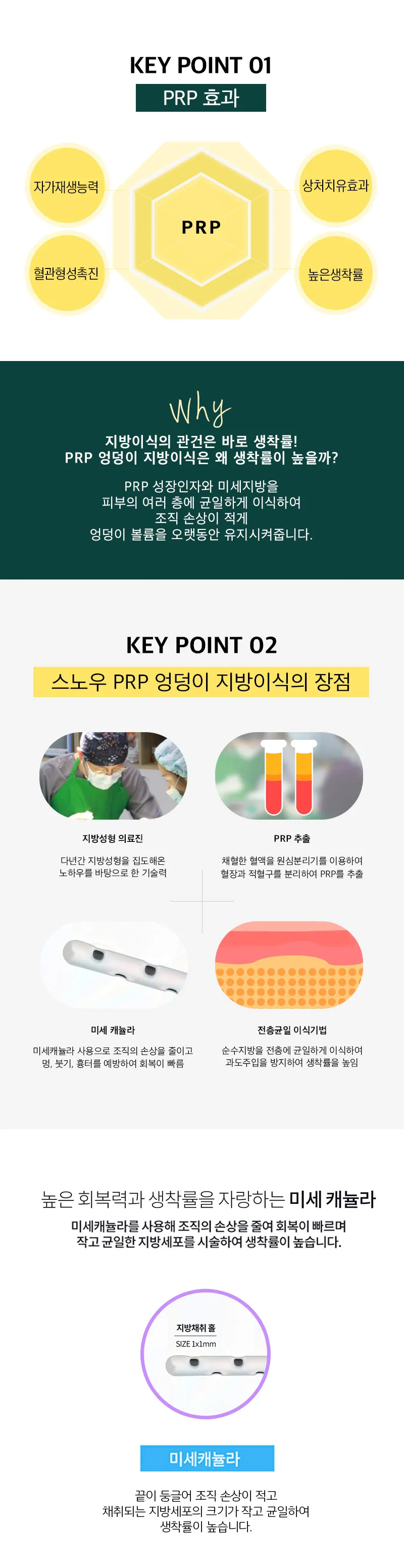 스노우의원 힙업 PRR 엉덩이지방이식 이벤트, 시술 상세 이미지