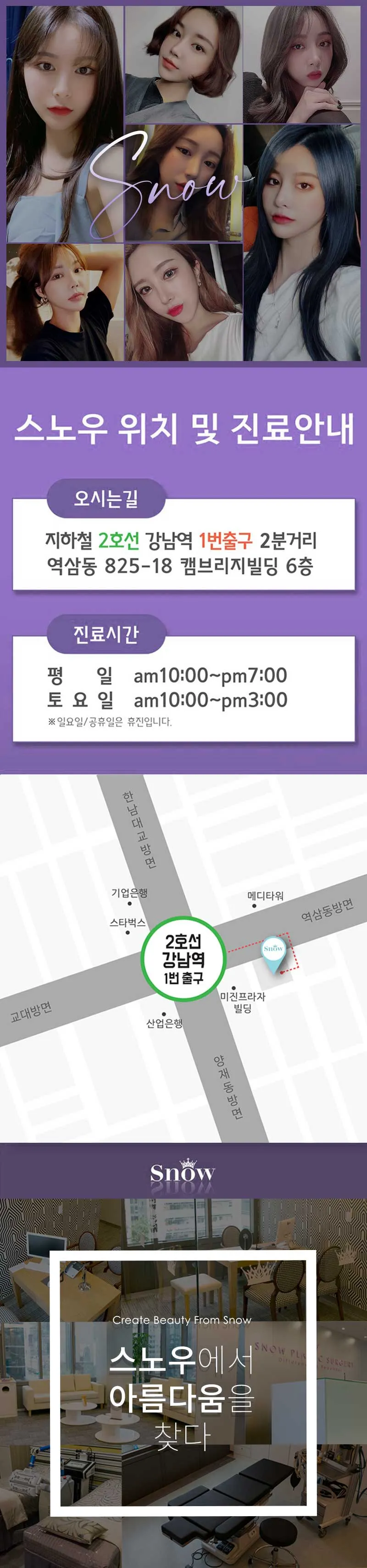 스노우의원 비밀눈성형 절개 눈재수술 이벤트, 시술 상세 이미지