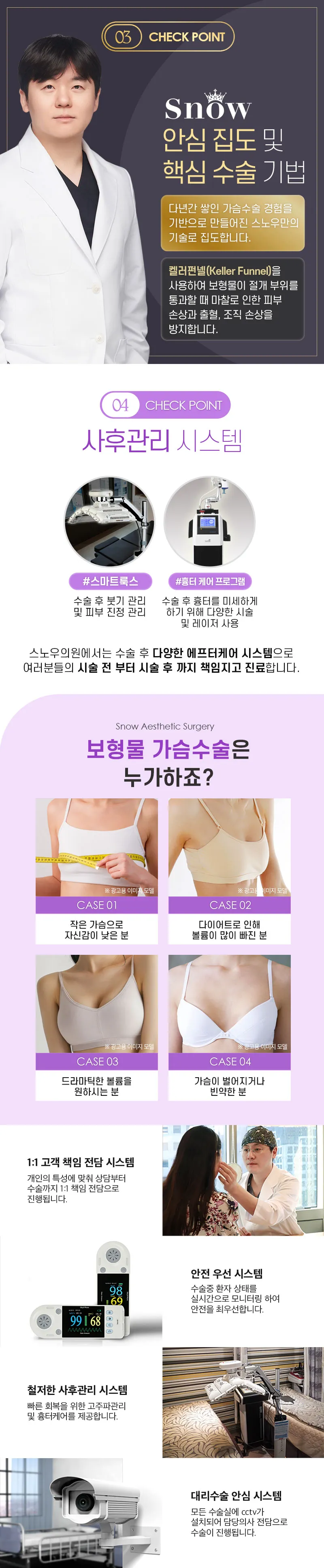 メント胸インプラント
