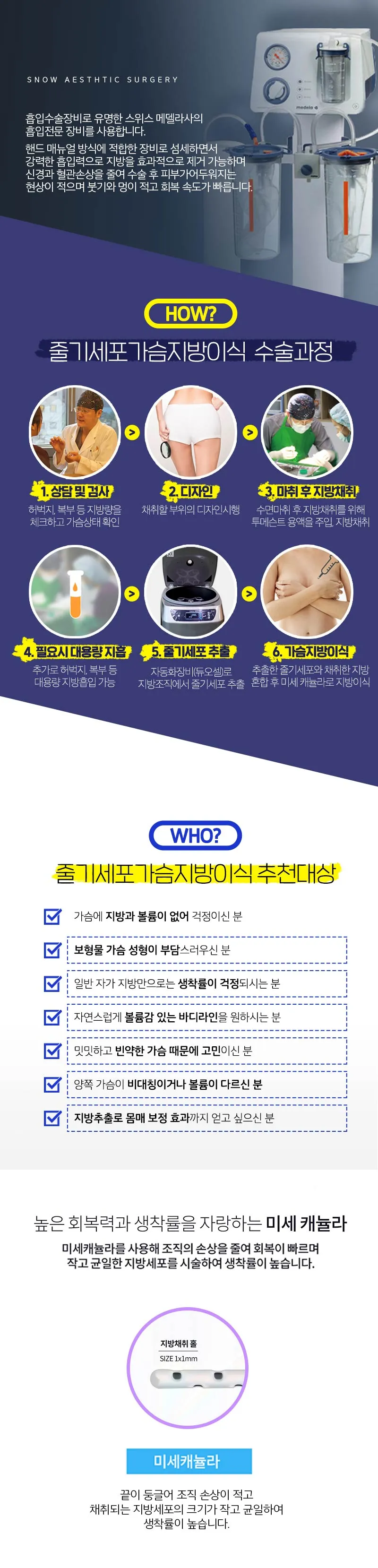 스노우의원 줄기세포 가슴지방이식 이벤트, 시술 상세 이미지