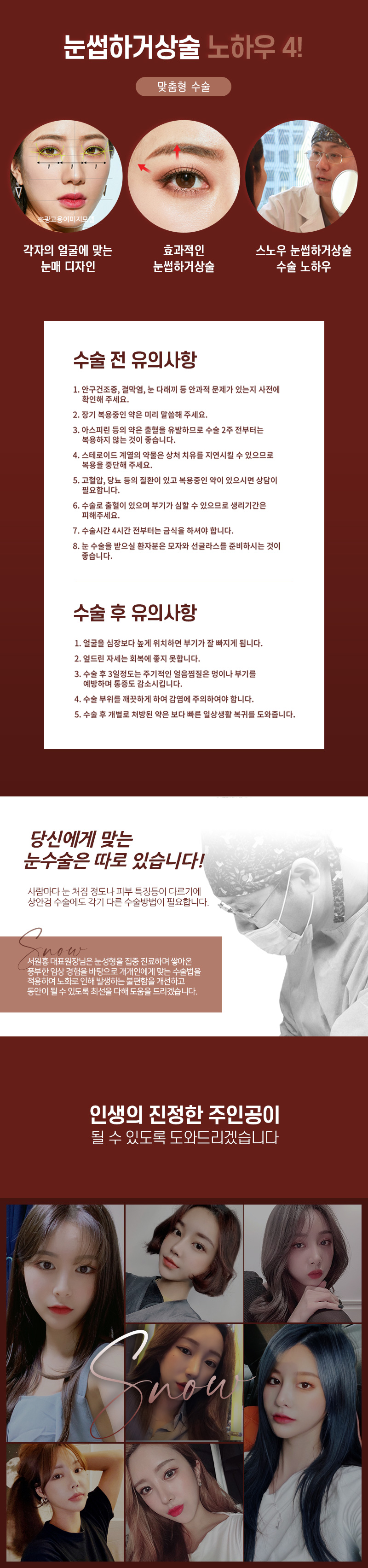 스노우의원 중년눈성형 상안검 눈썹하거상 이벤트, 시술 상세 이미지