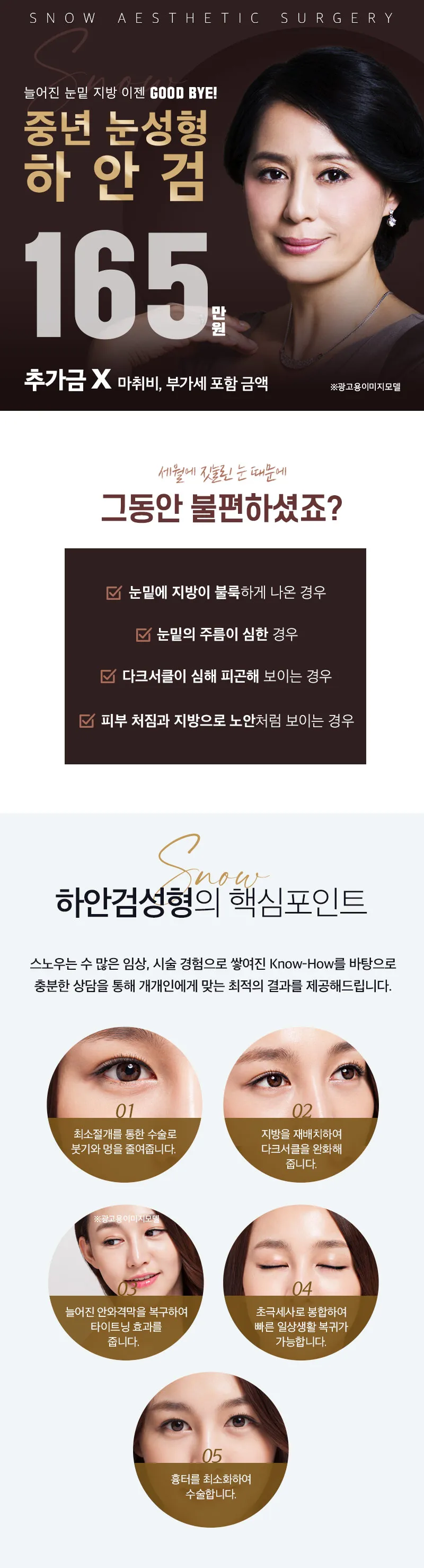 스노우의원 중년 눈성형 하안검 이벤트, 시술 상세 이미지