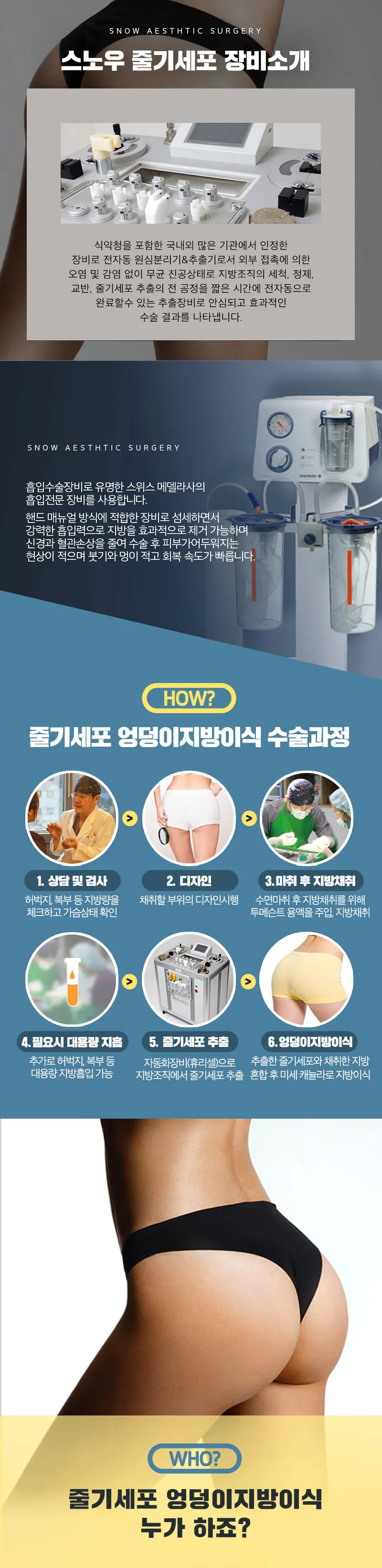 스노우의원 줄기세포 힙업 엉덩이지방이식 이벤트, 시술 상세 이미지