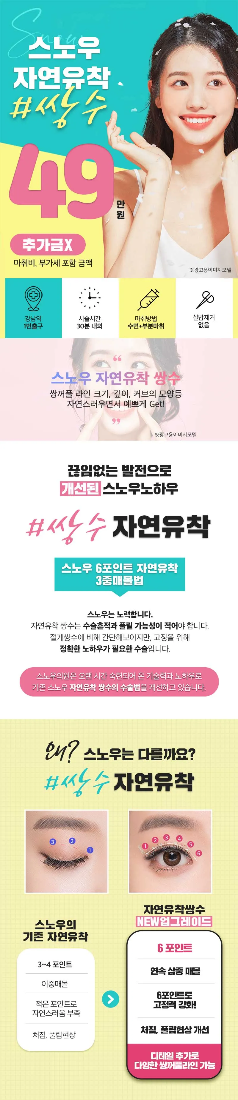 스노우의원 자연스러운 자연유착 쌍커풀 이벤트, 시술 상세 이미지