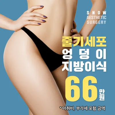 줄기세포 힙업 엉덩이지방이식 이벤트 썸네일 이미지