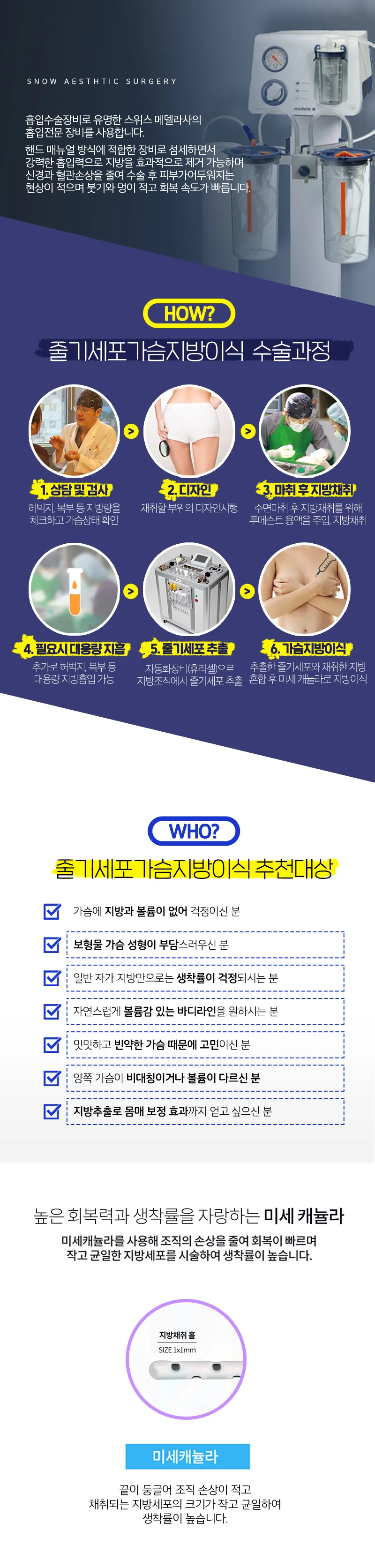 스노우의원 줄기세포 가슴지방이식 이벤트, 시술 상세 이미지