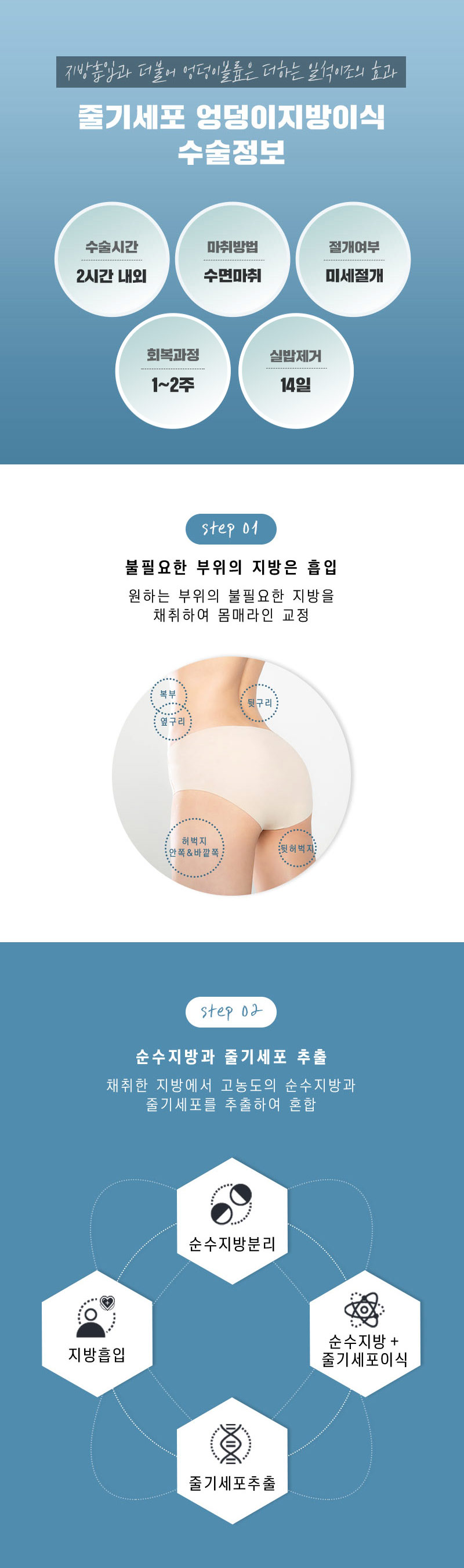 스노우의원 줄기세포 힙업 엉덩이지방이식 이벤트, 시술 상세 이미지