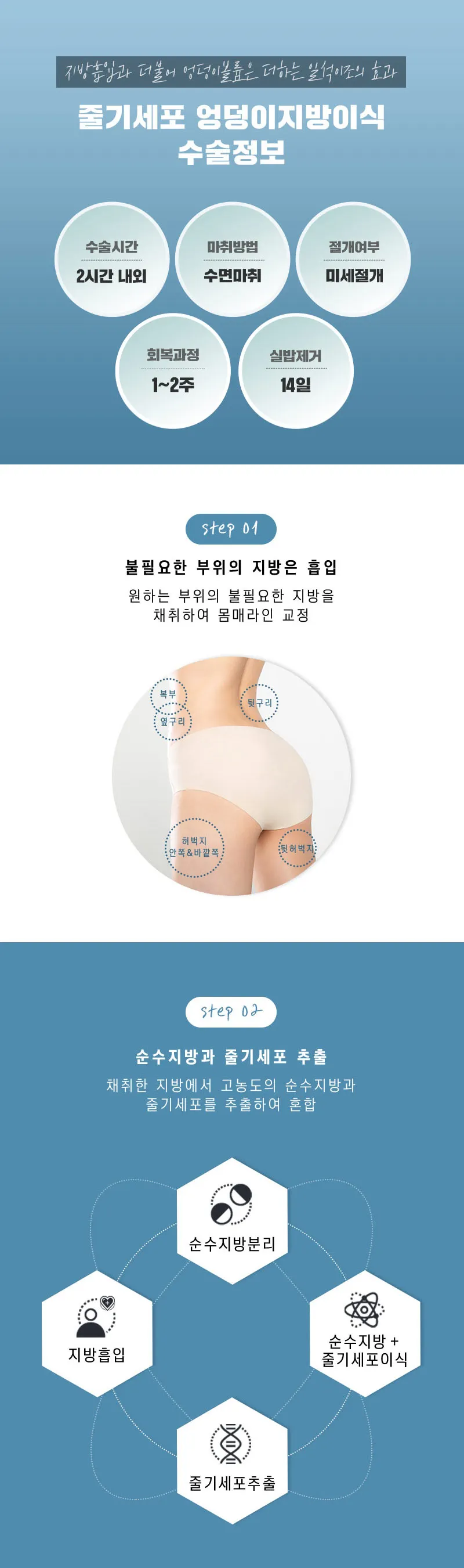 스노우의원 줄기세포 힙업 엉덩이지방이식 이벤트, 시술 상세 이미지