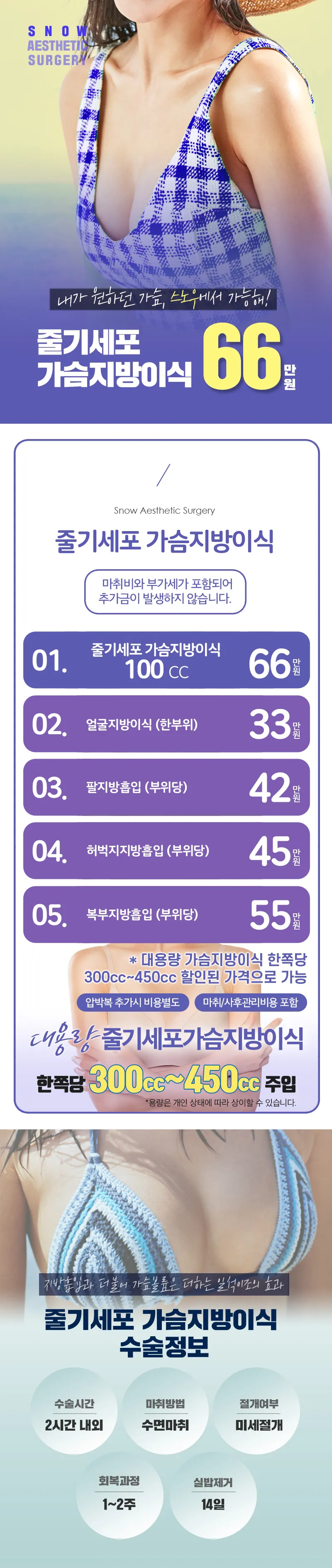 스노우의원 줄기세포 가슴지방이식 이벤트, 시술 상세 이미지