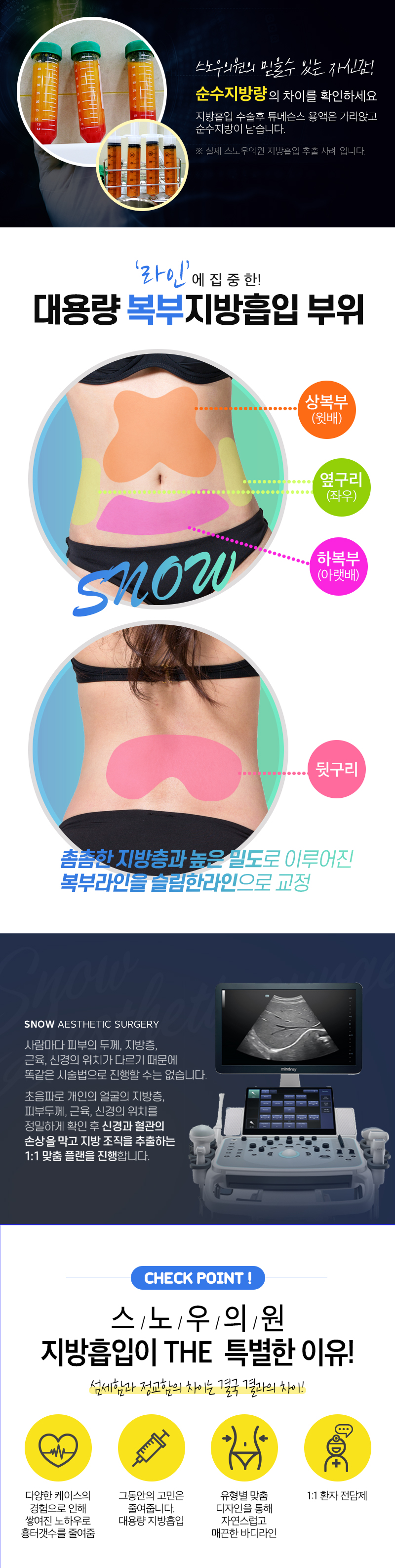 스노우의원 대용량 복부 지방흡입 이벤트, 시술 상세 이미지