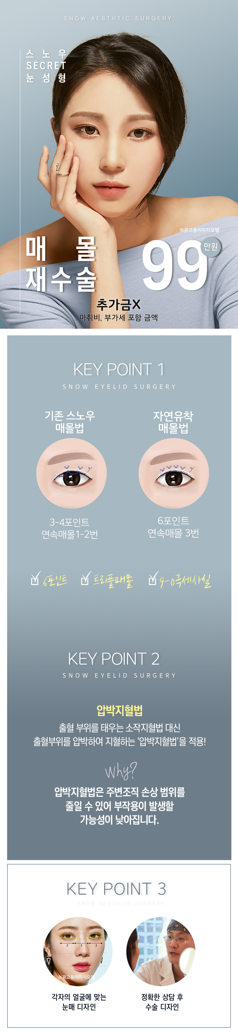 스노우의원 비밀눈성형 매몰재수술 이벤트, 시술 상세 이미지