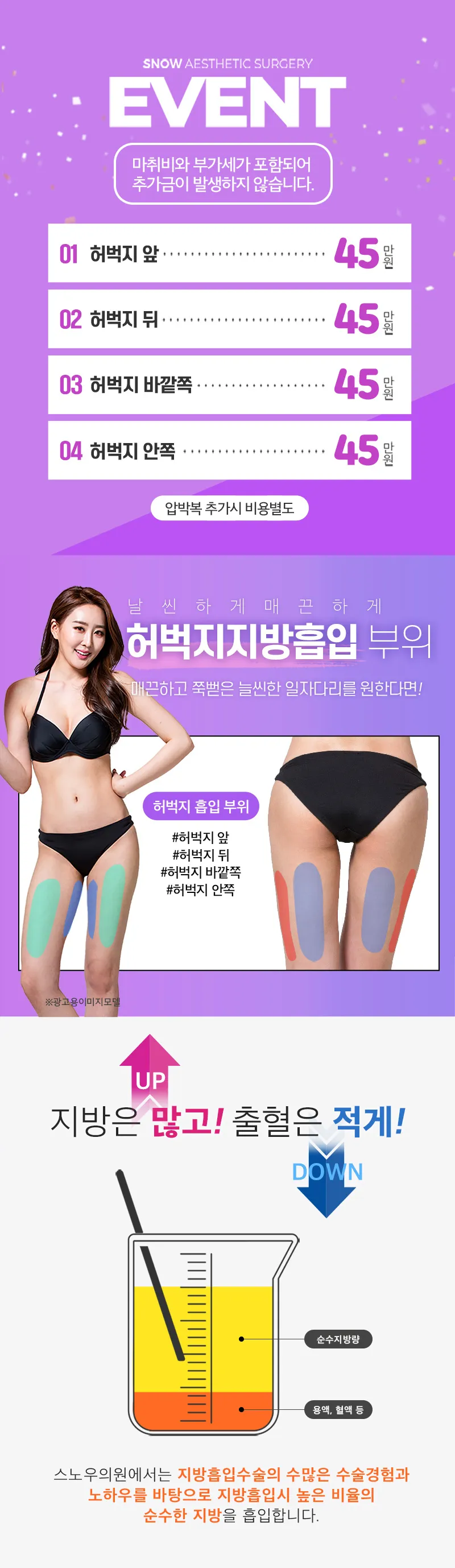스노우의원 대용량 허벅지 지방흡입 이벤트, 시술 상세 이미지