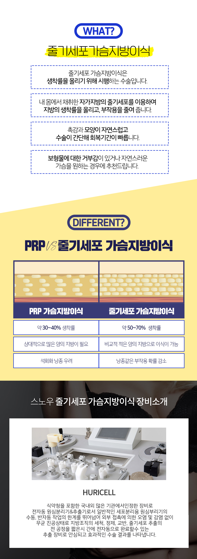 스노우의원 줄기세포 가슴지방이식 이벤트, 시술 상세 이미지