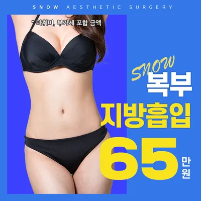대용량 복부 지방흡입 이벤트 썸네일 이미지