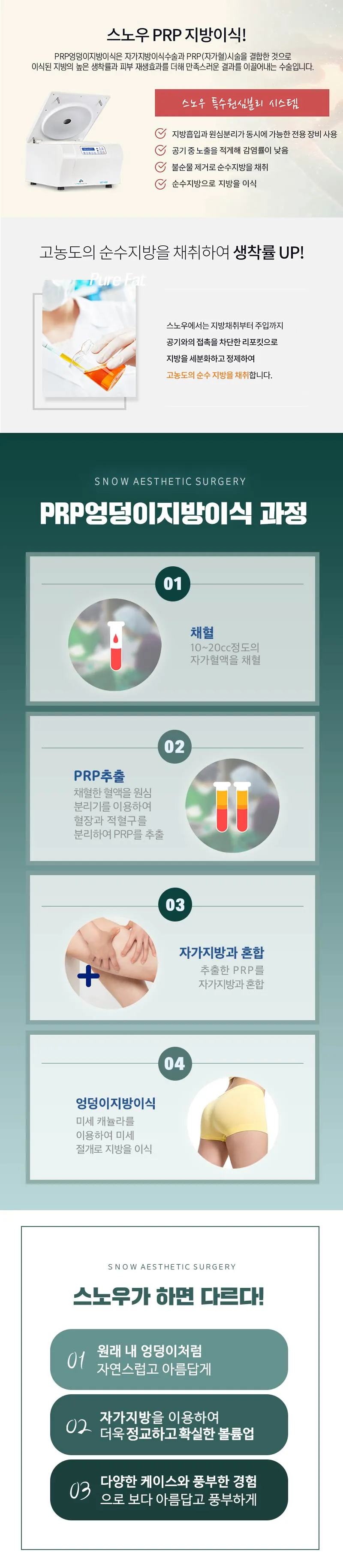 스노우의원 힙업 PRR 엉덩이지방이식 이벤트, 시술 상세 이미지
