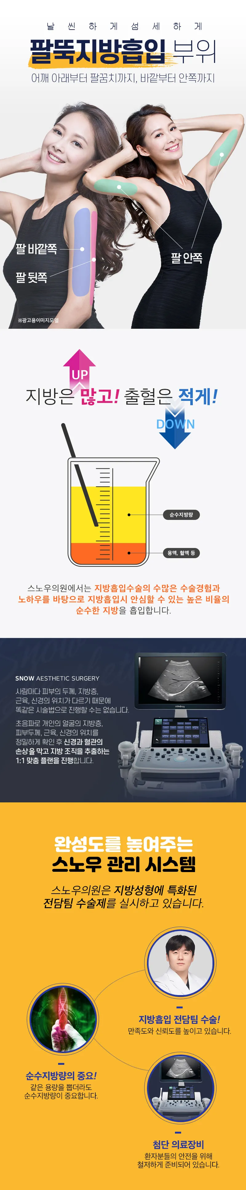 스노우의원 대용량 팔 지방흡입 이벤트, 시술 상세 이미지