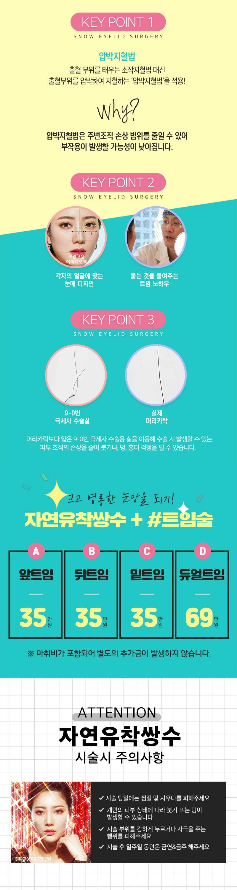 스노우의원 자연스러운 자연유착 쌍커풀 이벤트, 시술 상세 이미지