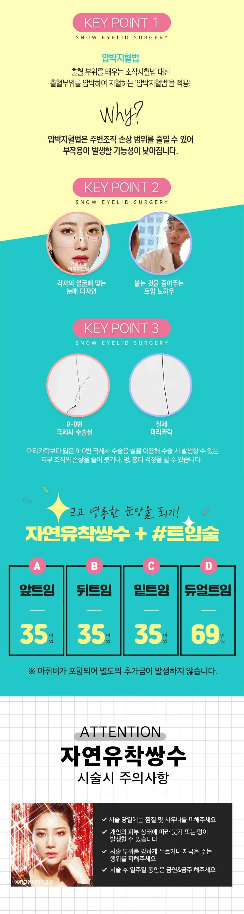 스노우의원 자연스러운 자연유착 쌍커풀 이벤트, 시술 상세 이미지