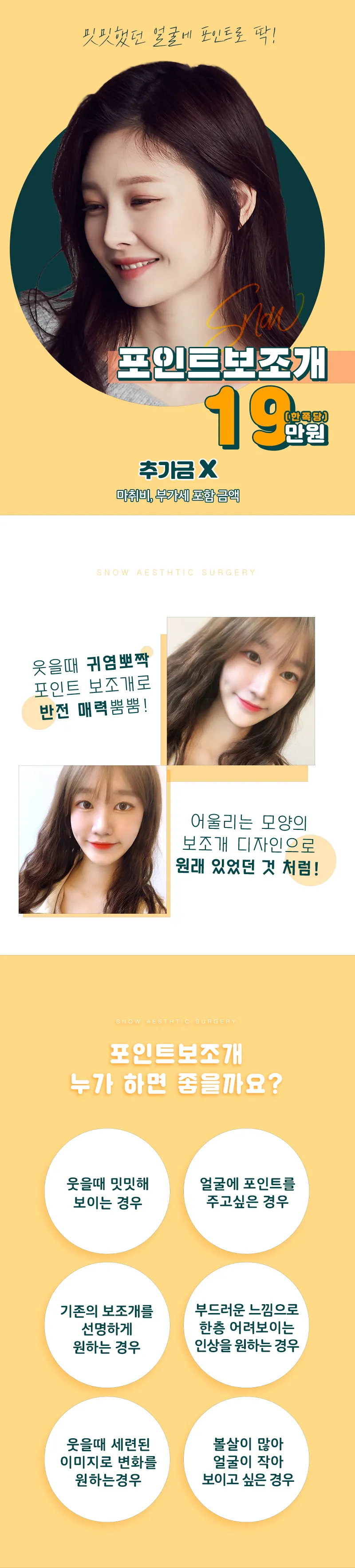 스노우의원 비절개 포인트 보조개 이벤트, 시술 상세 이미지