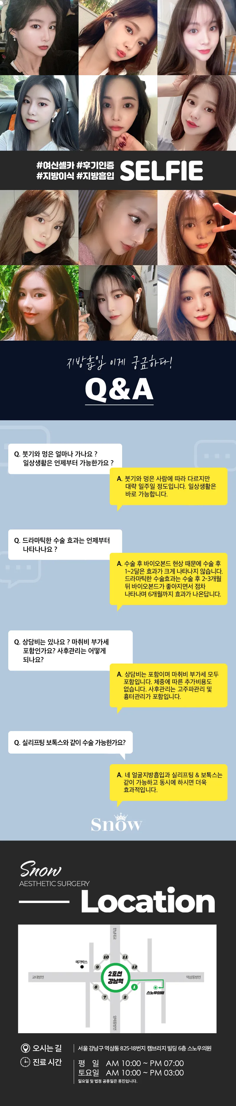스노우의원 대용량 얼굴지방흡입 이벤트, 시술 상세 이미지