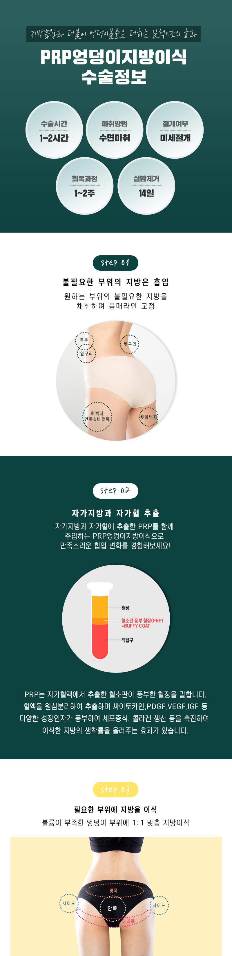 스노우의원 힙업 PRR 엉덩이지방이식 이벤트, 시술 상세 이미지