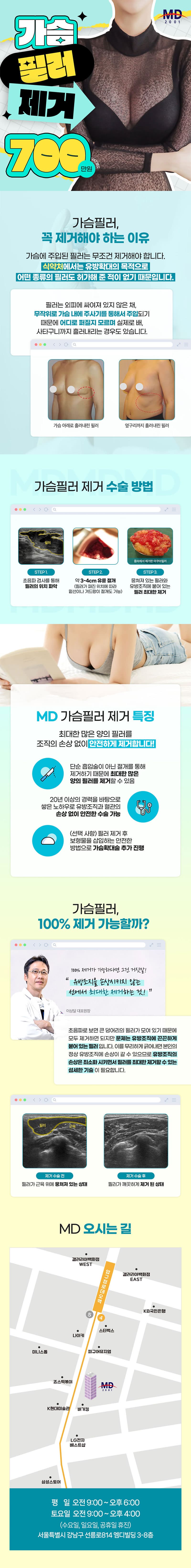 엠디외과의원 💙MD 가슴필러 제거❤ 이벤트, 시술 상세 이미지