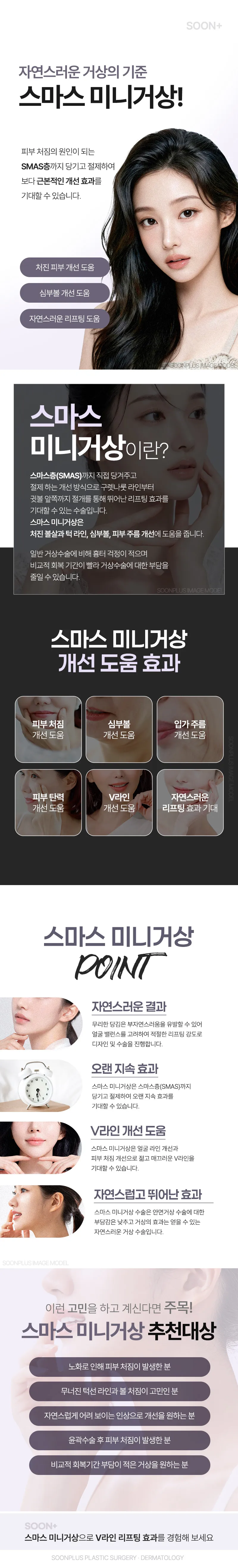 순플러스성형외과 순플러스_스마스 미니거상 이벤트, 시술 상세 이미지