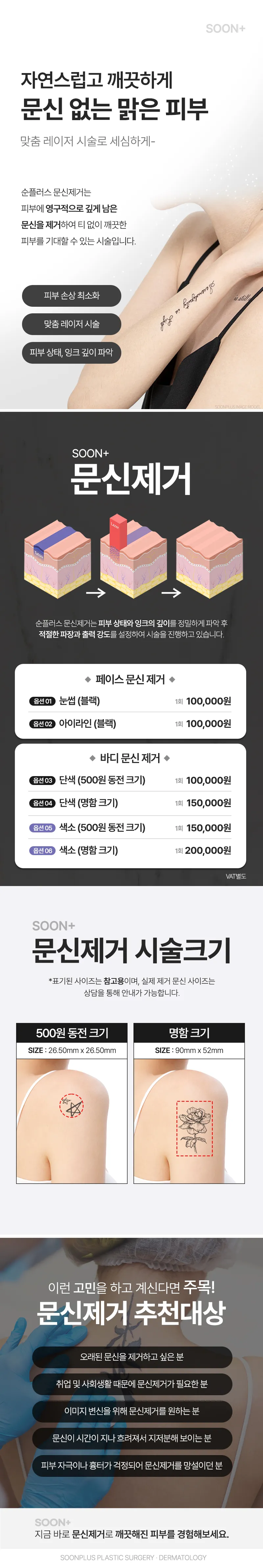 순플러스성형외과 순플러스 문신제거 이벤트, 시술 상세 이미지