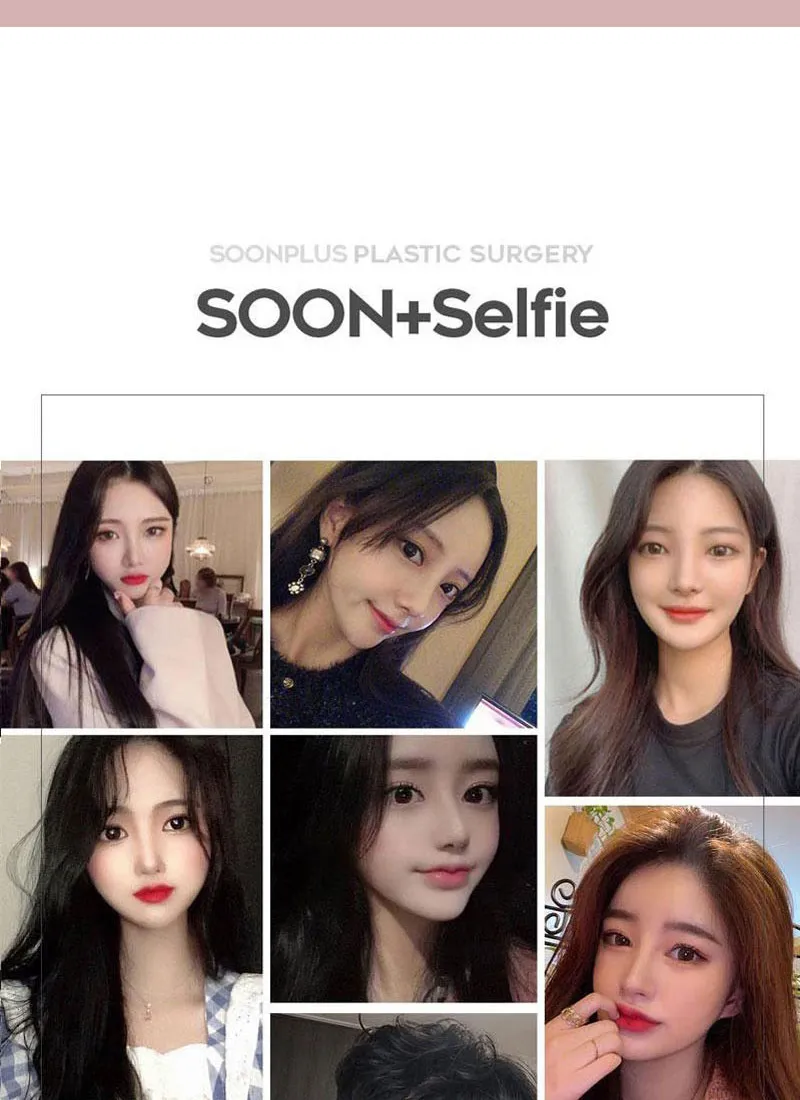 순플러스성형외과 순플러스 집착리프팅_민트실 이벤트, 시술 상세 이미지