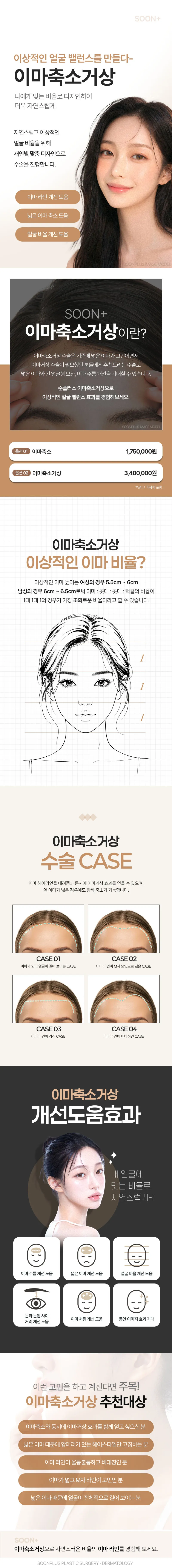 순플러스성형외과 순플러스_이마축소_이마축소거상 이벤트, 시술 상세 이미지