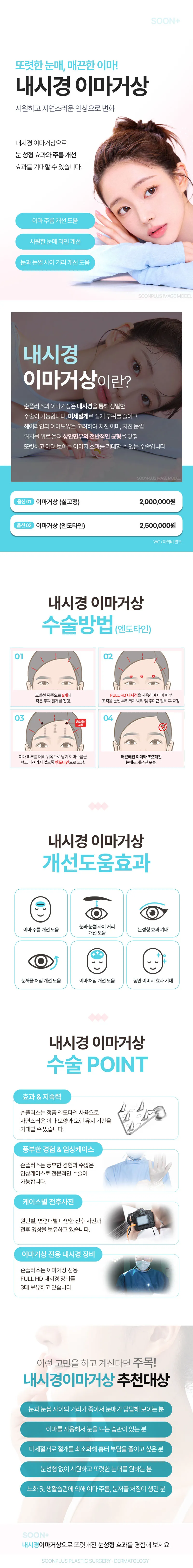 순플러스성형외과 순플러스_내시경이마거상 이벤트, 시술 상세 이미지