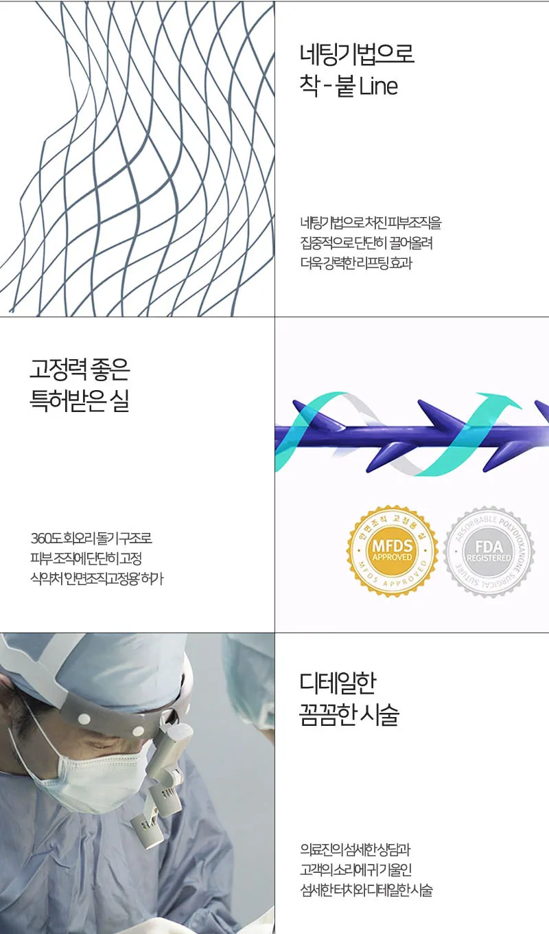 순플러스성형외과 순플러스 집착리프팅_민트실 이벤트, 시술 상세 이미지