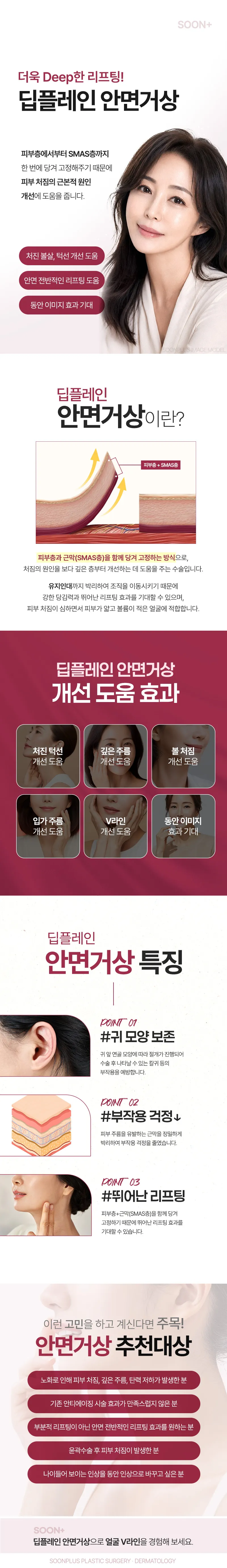 순플러스성형외과 순플러스_딥플레인 안면거상 이벤트, 시술 상세 이미지