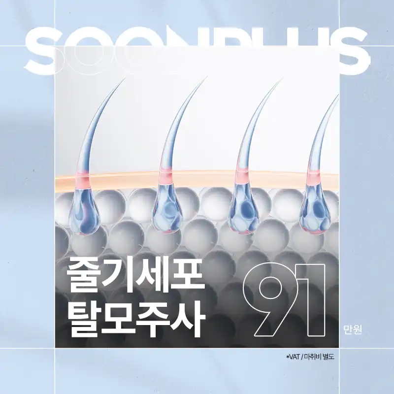 순플러스_줄기세포탈모주사