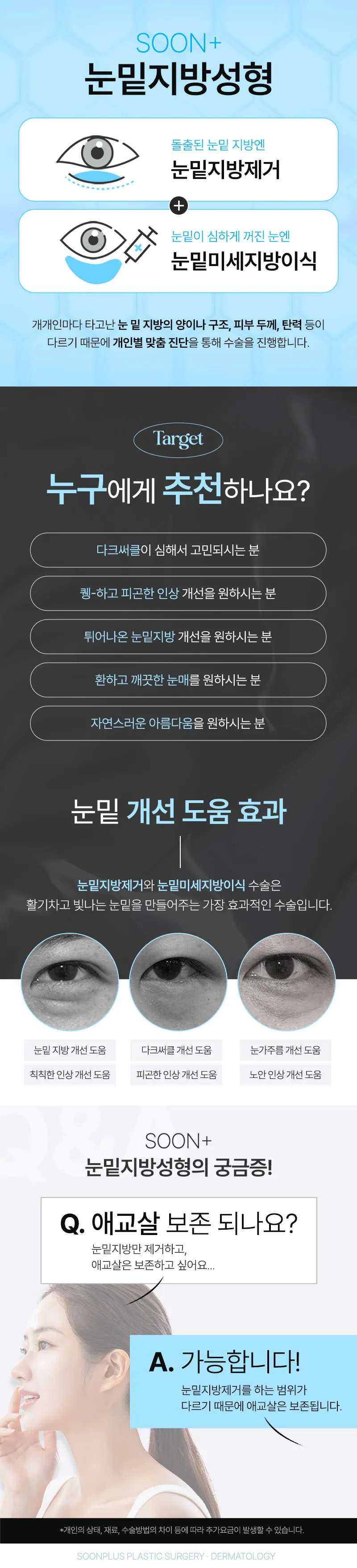 순플러스성형외과 순플러스_눈밑지방제거+눈밑지방이식 이벤트, 시술 상세 이미지