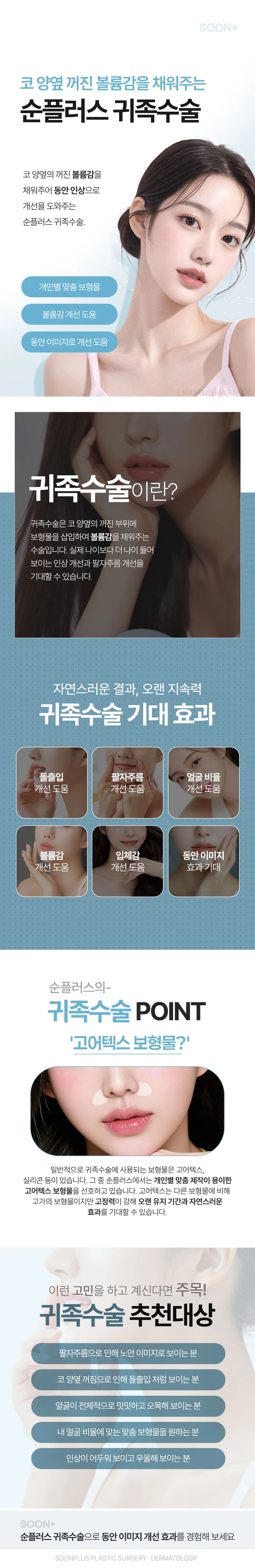 순플러스성형외과 순플러스 귀족수술 이벤트, 시술 상세 이미지