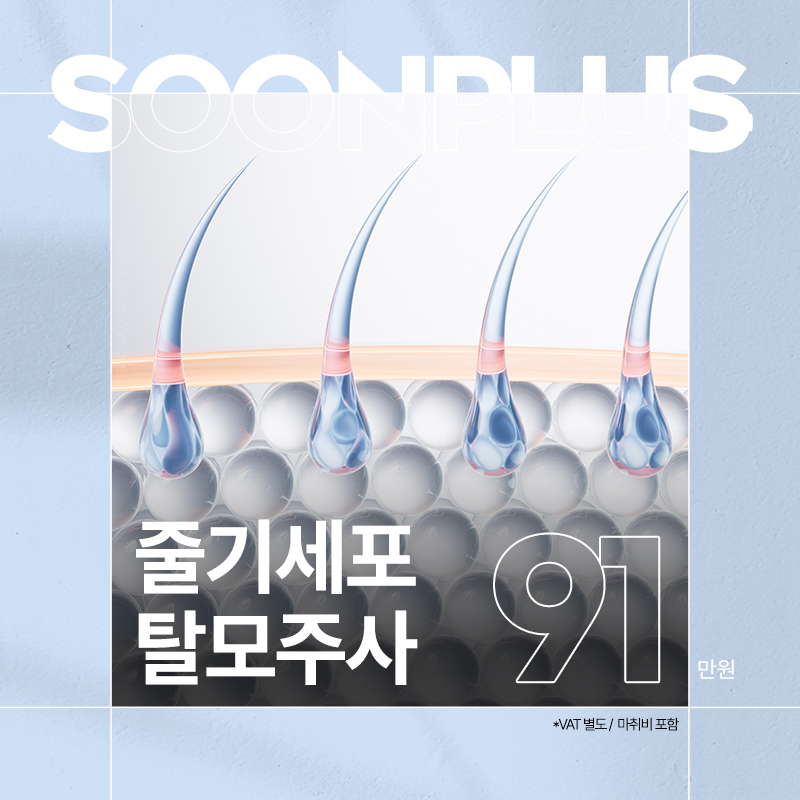 순플러스_줄기세포탈모주사